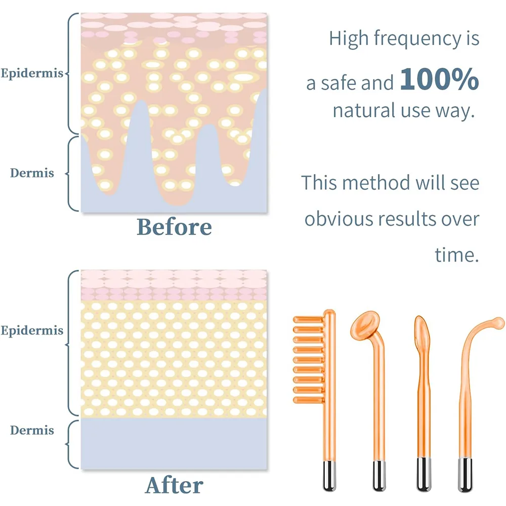 TUMAKOU High Frequency